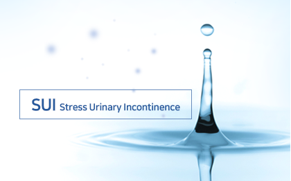 sui stress urinary incontinence