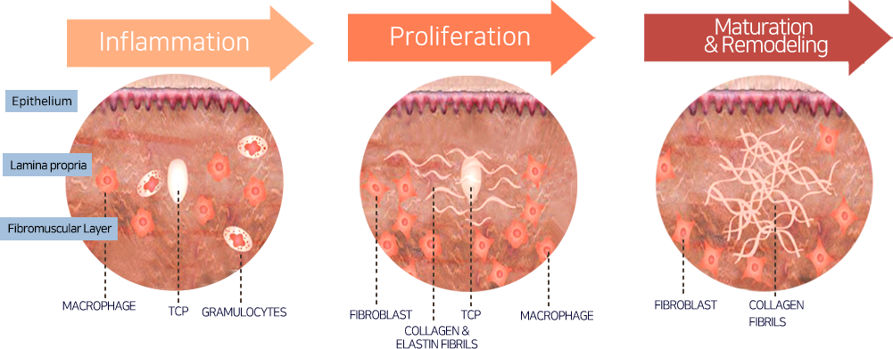 Mechanism of New Collagen Regeneration