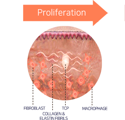 Mechanism of New Collagen Regeneration