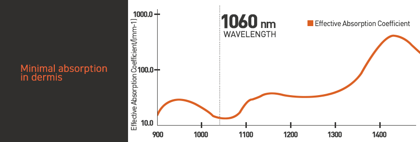 1060nm Wavelength Laser